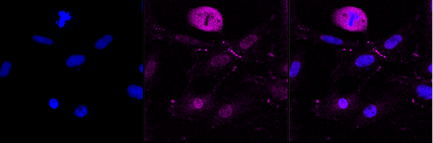 ATP binding cassette subfamily B member 1 antibody