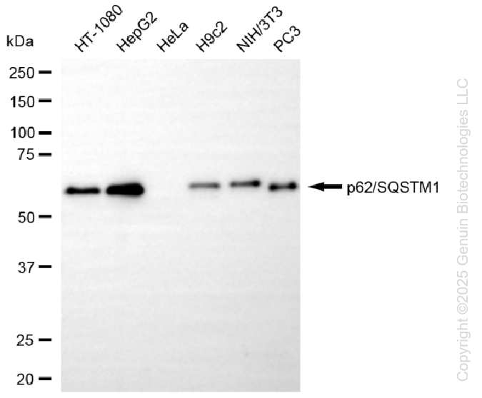SQSTM1 antibody