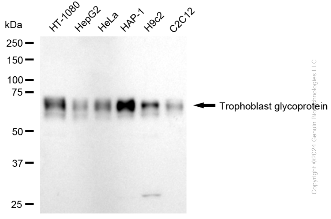 TPBG antibody