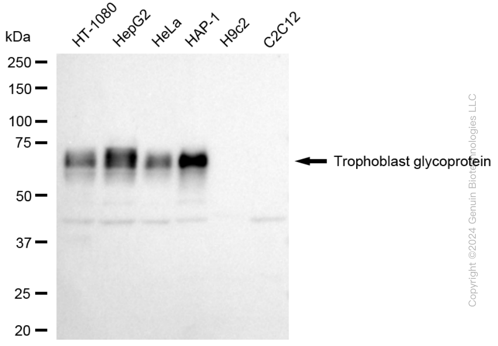 TPBG antibody