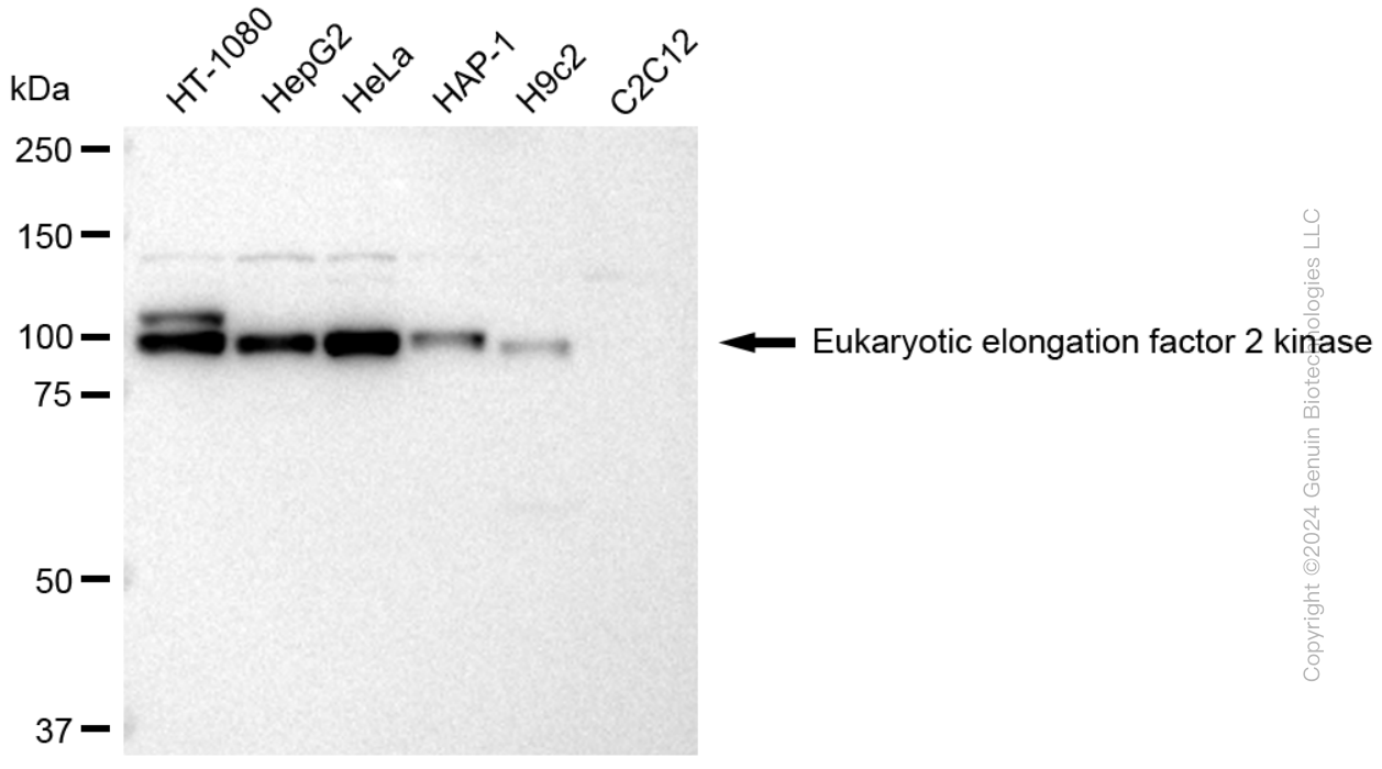 EEF2K antibody