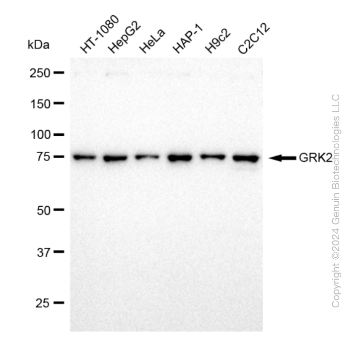 GRK2 antibody