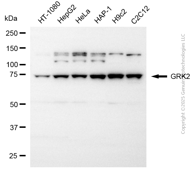 GRK2 antibody