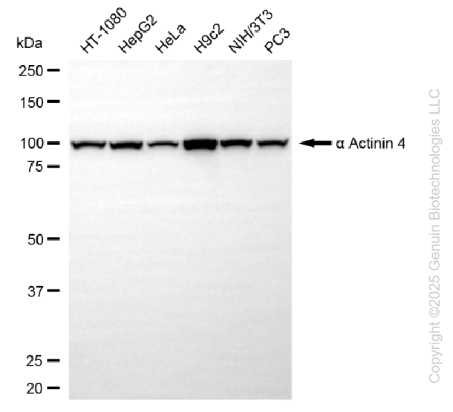 ACTN4 antibody