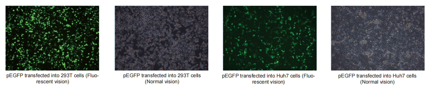 endofree maxi plasmid kit
