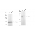 KD-Validated ABCD1 Rabbit mAb (20 μl)