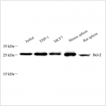 Anti-Bcl-2 Mouse mAb (100 μl)