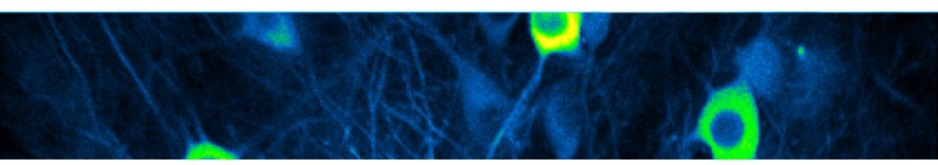 Transfection Reagents